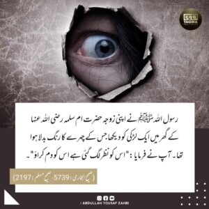 نظر لگنے پر دم کروانا
