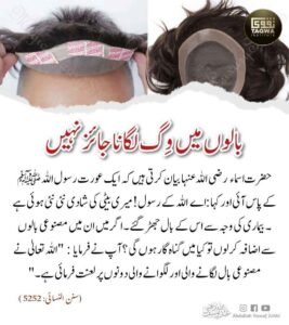 بالوں میں وگ لگانا جائز نہیں